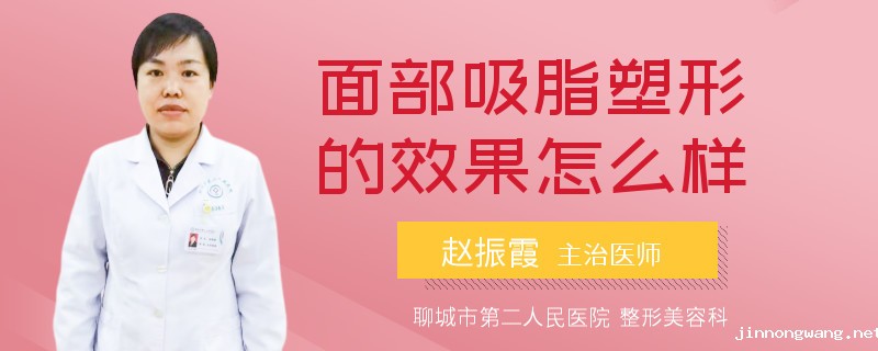 面部吸脂塑形的效果怎么样